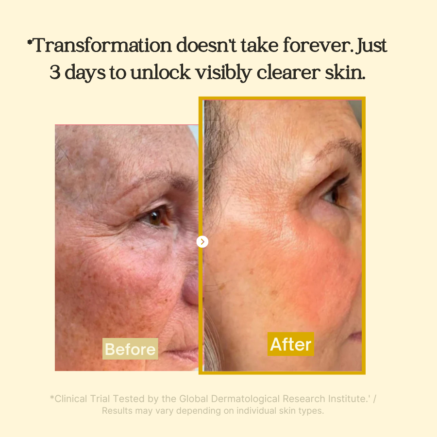 Medicube Kojic Acid Turmeric Night Wrapping Mask