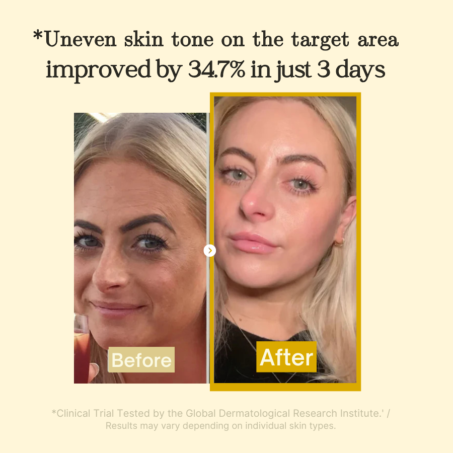 Medicube Kojic Acid Turmeric Night Wrapping Mask