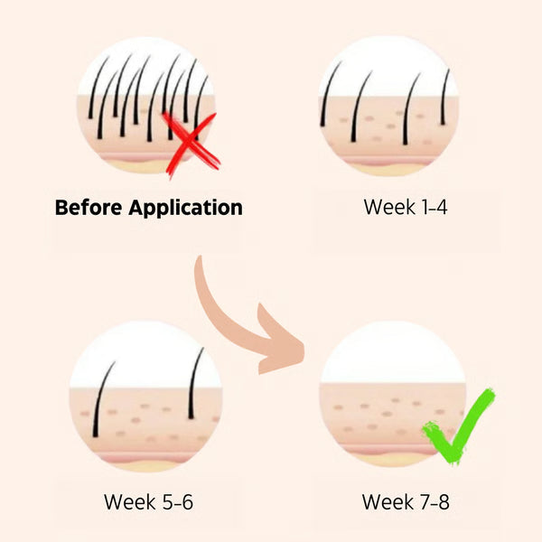 IPL Mini Laser Hair Remover